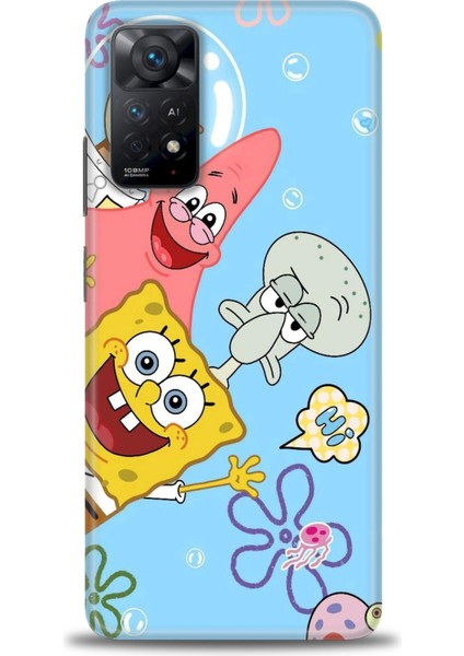 Xiaomi Redmi Note 11 Pro 4g Hd Baskılı Kılıf + Seramik Tam Kaplayan Ekran Koruyucu 452