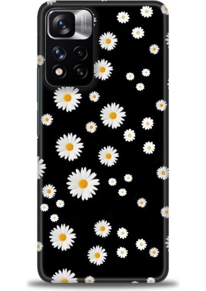 Xiaomi Redmi Note 11 Pro Plus Hd Baskılı Kılıf + Seramik Tam Kaplayan Ekran Koruyucu 131