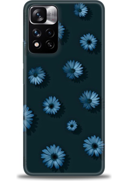 Xiaomi Redmi Note 11 Pro Plus Hd Baskılı Kılıf + Seramik Tam Kaplayan Ekran Koruyucu 136