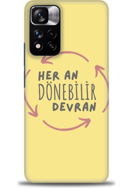 Xiaomi Redmi Note 11 Pro Plus Hd Baskılı Kılıf + Seramik Tam Kaplayan Ekran Koruyucu 167