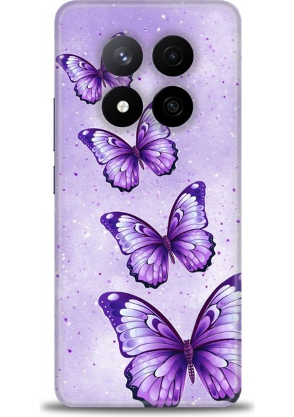 Xiaomi Redmi Note 14 Pro Plus Hd Baskılı Kılıf + Seramik Tam Kaplayan Ekran Koruyucu 296