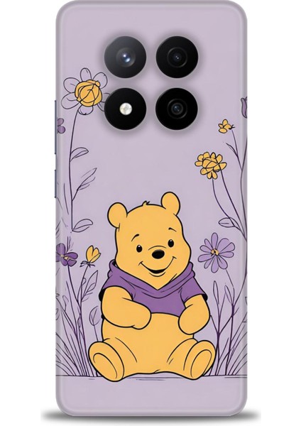 Xiaomi Redmi Note 14 Pro Plus Hd Baskılı Kılıf + Seramik Tam Kaplayan Ekran Koruyucu 55