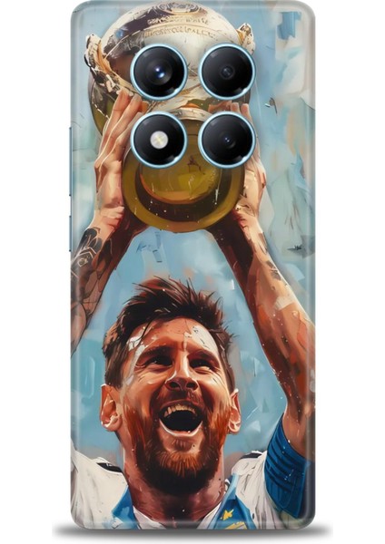 Xiaomi Redmi Note 14 Pro 5g Hd Baskılı Kılıf + Seramik Tam Kaplayan Ekran Koruyucu 14