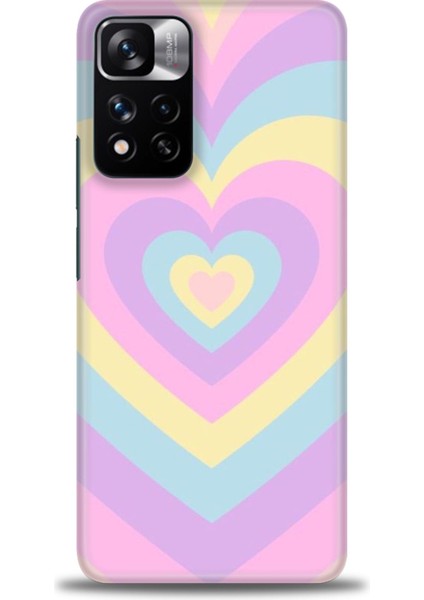 Xiaomi Redmi Note 11 Pro Plus Hd Baskılı Kılıf + Seramik Tam Kaplayan Ekran Koruyucu 198