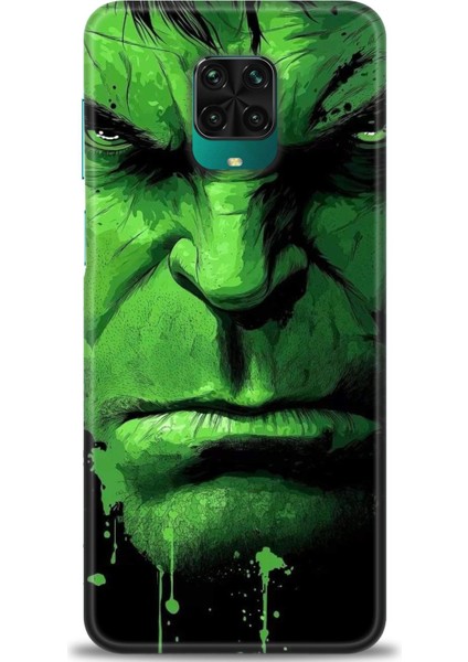 Xiaomi Redmi Note 9 Pro Hd Baskılı Kılıf + Seramik Tam Kaplayan Ekran Koruyucu 94