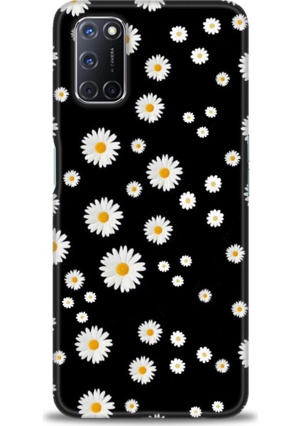 Oppo A72 Kılıf Hd Baskılı Kılıf + Seramik Tam Kaplayan Ekran Koruyucu 131