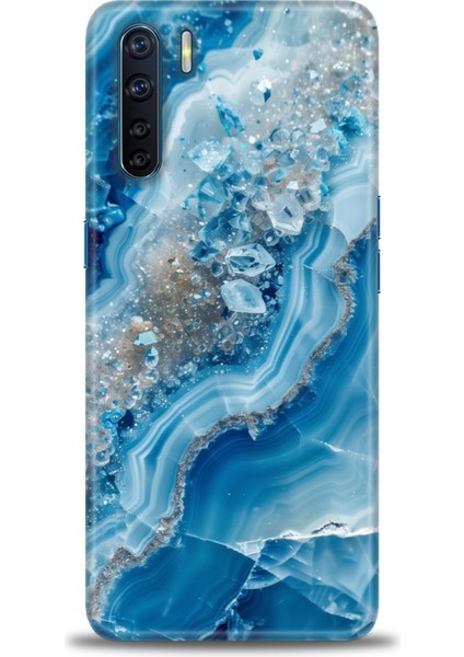 Oppo A91 Kılıf Hd Baskılı Kılıf + Seramik Tam Kaplayan Ekran Koruyucu 317