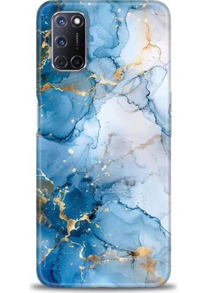 Oppo A92 Kılıf Hd Baskılı Kılıf + Seramik Tam Kaplayan Ekran Koruyucu 312