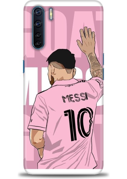 Oppo A91 Kılıf Hd Baskılı Kılıf + Seramik Tam Kaplayan Ekran Koruyucu 16