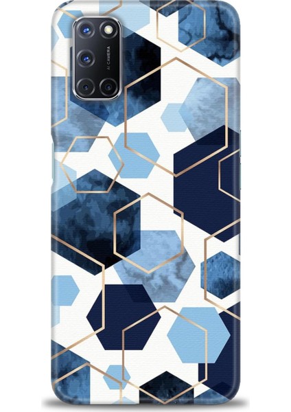 Oppo A72 Kılıf Hd Baskılı Kılıf + Seramik Tam Kaplayan Ekran Koruyucu 324