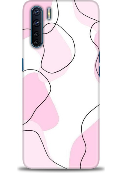 Oppo A91 Kılıf Hd Baskılı Kılıf + Seramik Tam Kaplayan Ekran Koruyucu 171