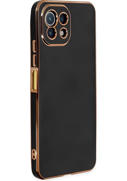 Xiaomi Mi 11 Lite Kılıf Parlak Tasrım Kamera Korumalı Ultra Yumuşak Esnek A+ Kalite Kapak