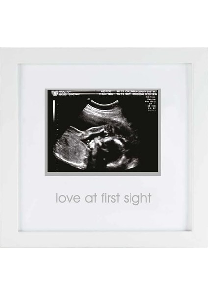 Ilk Görüşte Aşk Sonogram Resim Çerçevesi, Hamilelik Hatırası Fotoğraf Çerçevesi, Cinsiyetsiz Bebek Odası Dekoru, Anneler Günü Aksesuarı, Beyaz