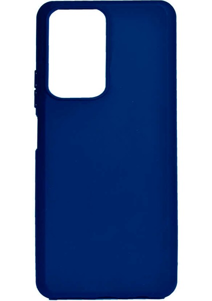 Xiaomi Redmi Note 10 Pro Kılıf Zore Biye Silikon Kılıf