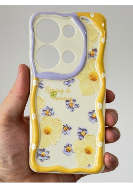 Xiaomi Redmi Note 13 Pro 5g Kılıf Desenli Kamera Korumalı Papatya Çiçek Renkli Silikon Kapak fırsatları
