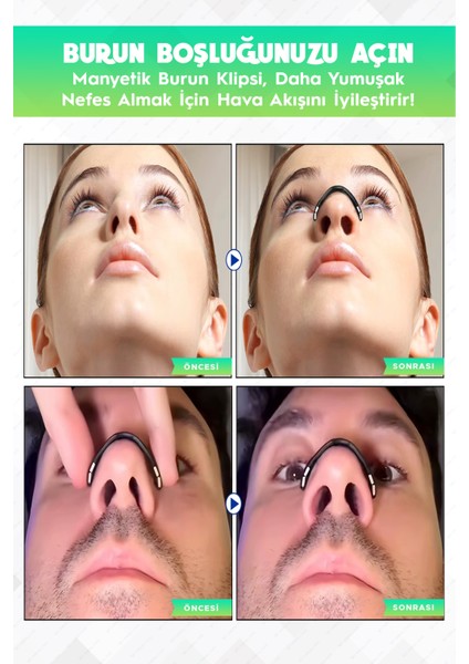 Siyah Renk Burun Bandı (15'li Paket)