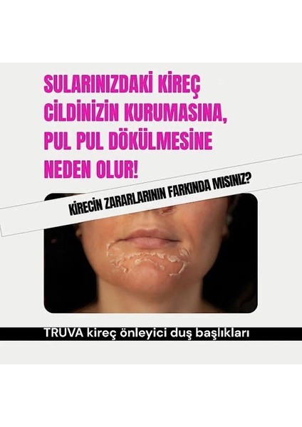 10 Fonksiyonlu Su Tasarruflu Duş Başlığı 10 Adet Yedek Filtreli Kireç Önleyici ve Yüksek Basınçlı