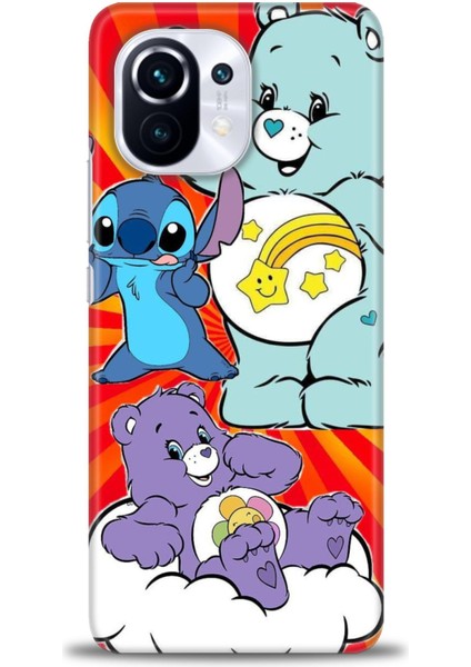 Xiaomi Mi 11 Kılıf Hd Baskılı Kılıf + Seramik Tam Kaplayan Ekran Koruyucu 492