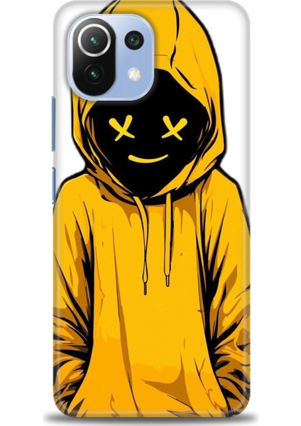 Xiaomi Mi 11 Lite Kılıf Hd Baskılı Kılıf + Seramik Tam Kaplayan Ekran Koruyucu 358