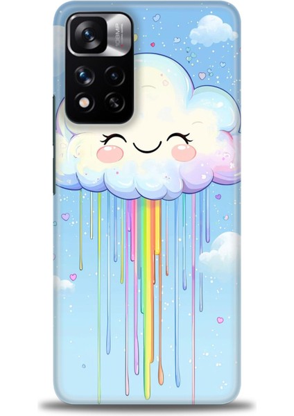 Xiaomi Redmi Note 11 Pro Plus Hd Baskılı Kılıf + Seramik Tam Kaplayan Ekran Koruyucu 307