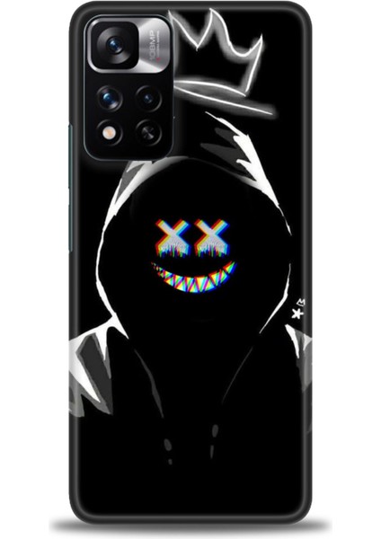Xiaomi Redmi Note 11 Pro Plus Hd Baskılı Kılıf + Seramik Tam Kaplayan Ekran Koruyucu 351