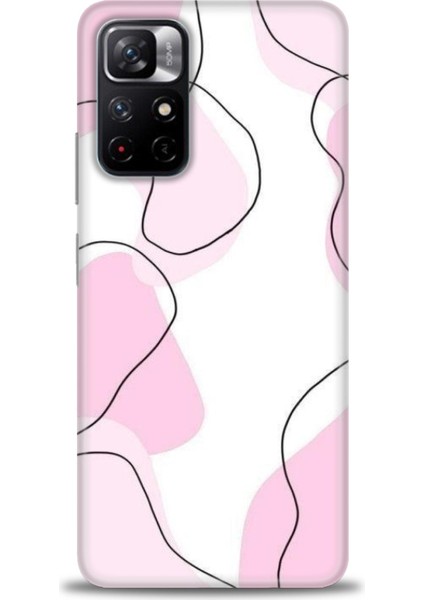 Xiaomi Redmi Note 11 Hd Baskılı Kılıf + Seramik Tam Kaplayan Ekran Koruyucu 171