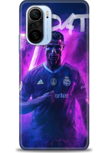 Xiaomi Mi 11I Kılıf Hd Baskılı Kılıf + Seramik Tam Kaplayan Ekran Koruyucu 9