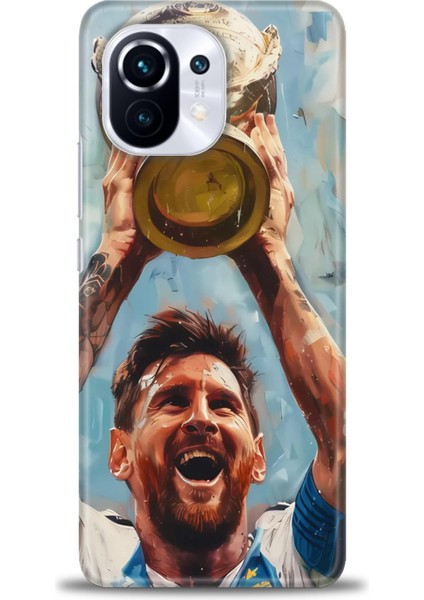 Xiaomi Mi 11 Kılıf Hd Baskılı Kılıf + Seramik Tam Kaplayan Ekran Koruyucu 14