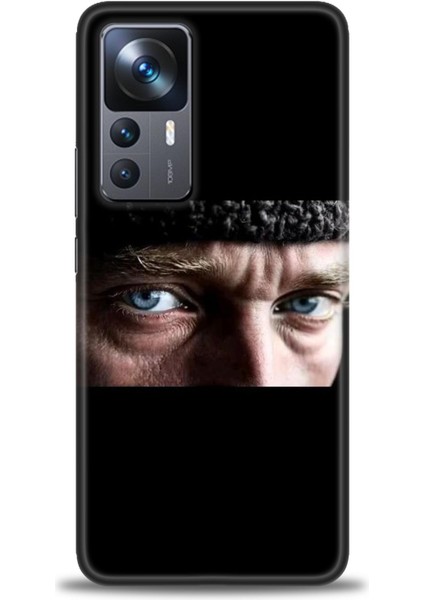 Xiaomi Mi 12T Pro Kılıf Hd Baskılı Kılıf + Seramik Tam Kaplayan Ekran Koruyucu 28