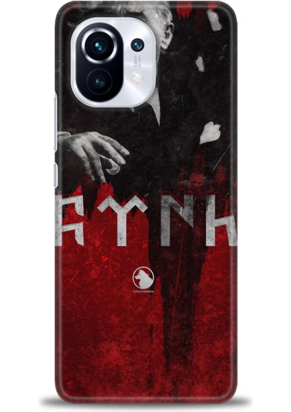 Xiaomi Mi 11 Kılıf Hd Baskılı Kılıf + Seramik Tam Kaplayan Ekran Koruyucu 23