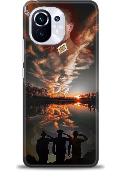 Xiaomi Mi 11 Kılıf Hd Baskılı Kılıf + Seramik Tam Kaplayan Ekran Koruyucu 26