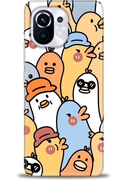 Xiaomi Mi 11 Kılıf Hd Baskılı Kılıf + Seramik Tam Kaplayan Ekran Koruyucu 497