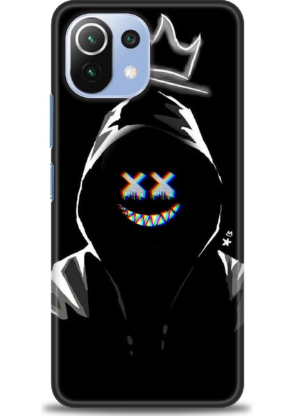 Xiaomi Mi 11 Lite Kılıf Hd Baskılı Kılıf + Seramik Tam Kaplayan Ekran Koruyucu 351