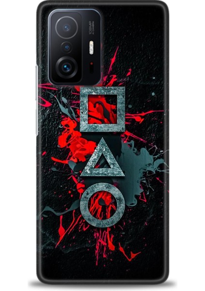 Xiaomi Mi 11T Kılıf Hd Baskılı Kılıf + Seramik Tam Kaplayan Ekran Koruyucu 281