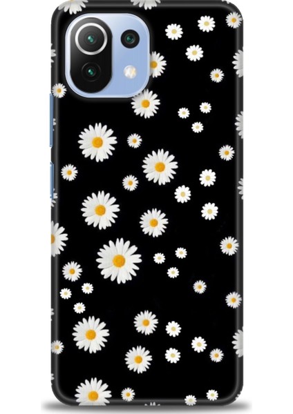 Xiaomi Mi 11 Lite Kılıf Hd Baskılı Kılıf + Seramik Tam Kaplayan Ekran Koruyucu 131