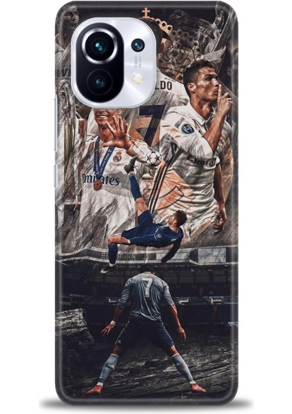 Xiaomi Mi 11 Kılıf Hd Baskılı Kılıf + Seramik Tam Kaplayan Ekran Koruyucu 10