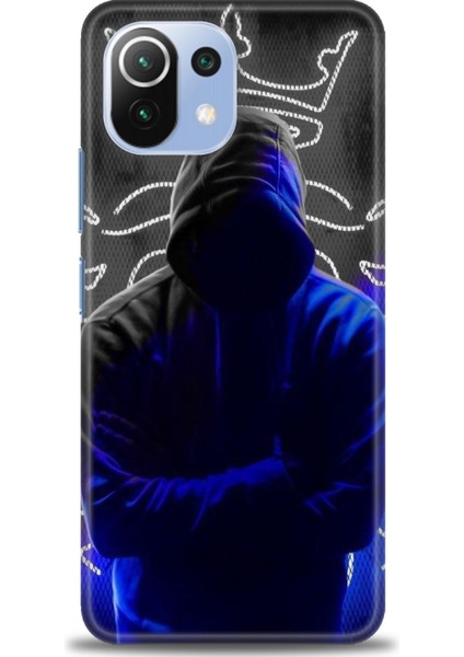 Xiaomi Mi 11 Lite Kılıf Hd Baskılı Kılıf + Seramik Tam Kaplayan Ekran Koruyucu 357