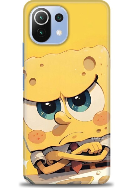 Xiaomi Mi 11 Lite Kılıf Hd Baskılı Kılıf + Seramik Tam Kaplayan Ekran Koruyucu 459