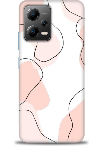 Xiaomi Poco X5 5g Kılıf Hd Baskılı Kılıf + Seramik Tam Kaplayan Ekran Koruyucu 180
