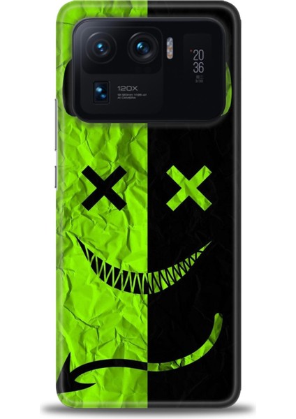 Xiaomi Mi 11 Ultra Kılıf Hd Baskılı Kılıf + Seramik Tam Kaplayan Ekran Koruyucu 360