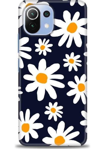 Xiaomi Mi 11 Lite Kılıf Hd Baskılı Kılıf + Seramik Tam Kaplayan Ekran Koruyucu 139