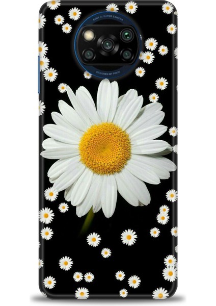 Xiaomi Poco X3 Pro Kılıf Hd Baskılı Kılıf + Seramik Tam Kaplayan Ekran Koruyucu 134