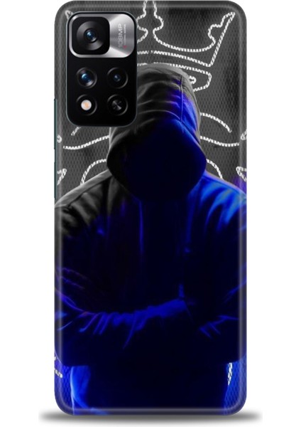 Xiaomi Redmi Note 11 Pro Plus Hd Baskılı Kılıf + Seramik Tam Kaplayan Ekran Koruyucu 357