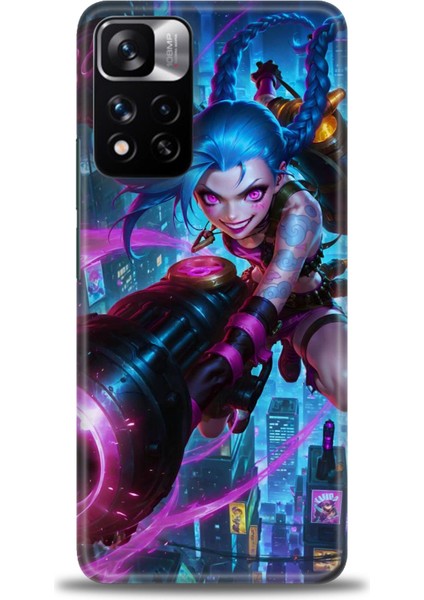 Xiaomi Redmi Note 11 Pro Plus Hd Baskılı Kılıf + Seramik Tam Kaplayan Ekran Koruyucu 280