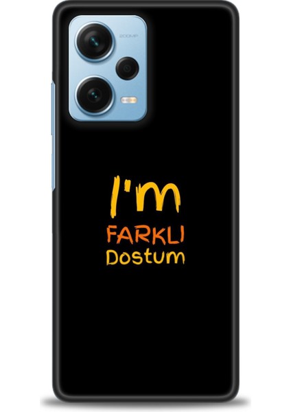 Xiaomi Redmi Note 12 Pro Plus Hd Baskılı Kılıf + Seramik Tam Kaplayan Ekran Koruyucu 399