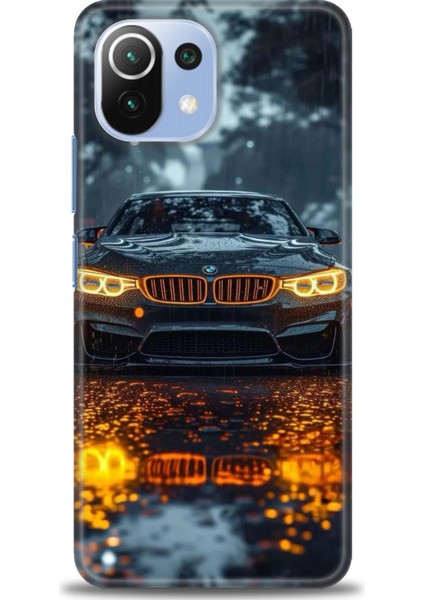 Xiaomi Mi 11 Lite Kılıf Hd Baskılı Kılıf + Seramik Tam Kaplayan Ekran Koruyucu 488