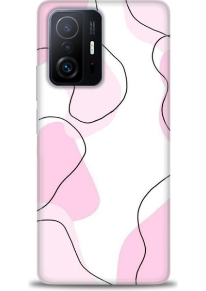 Xiaomi Mi 11T Kılıf Hd Baskılı Kılıf + Seramik Tam Kaplayan Ekran Koruyucu 171