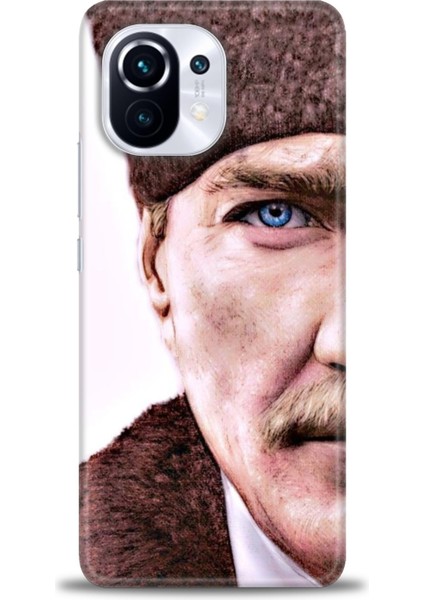 Xiaomi Mi 11 Kılıf Hd Baskılı Kılıf + Seramik Tam Kaplayan Ekran Koruyucu 29