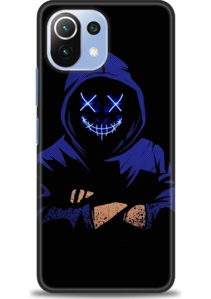 Xiaomi Mi 11 Lite Kılıf Hd Baskılı Kılıf + Seramik Tam Kaplayan Ekran Koruyucu 359