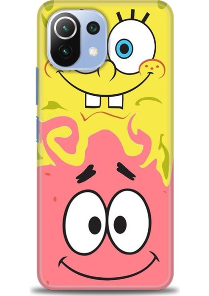 Xiaomi Mi 11 Lite Kılıf Hd Baskılı Kılıf + Seramik Tam Kaplayan Ekran Koruyucu 453